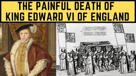 edward tudor illness|edward the tudor king.